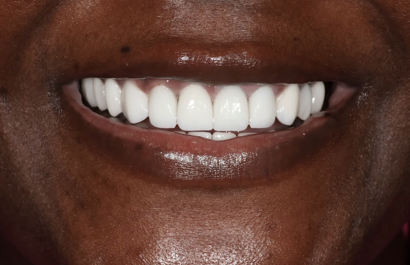 Close-up of a smile