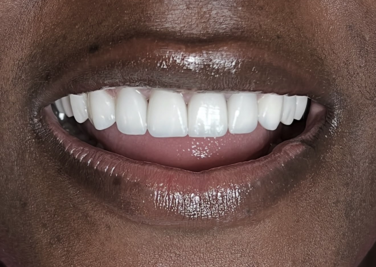 Close-up smile photograph