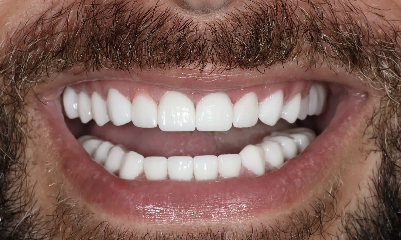 Close-up of a smile with the lips parted