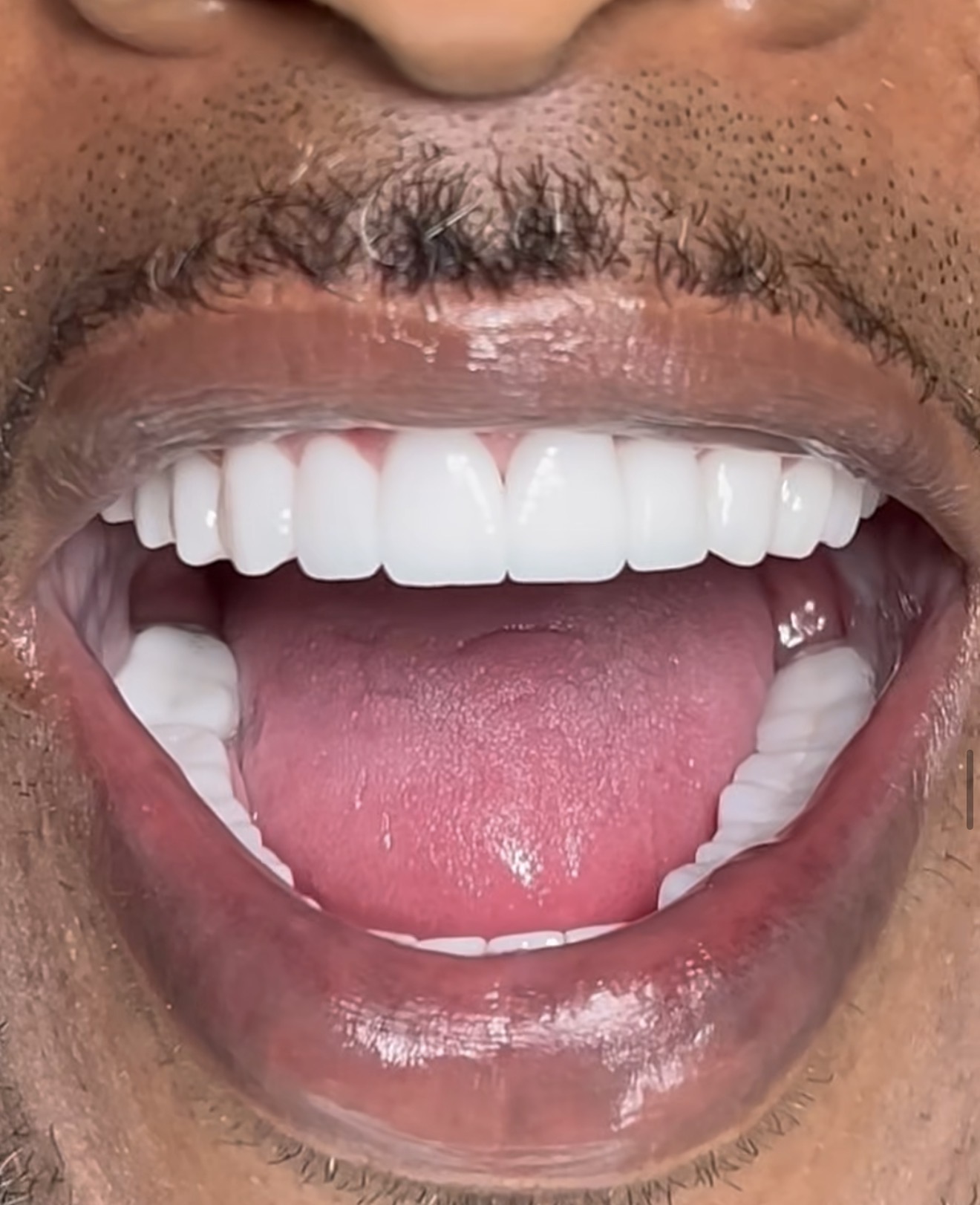 Close-up smile photograph