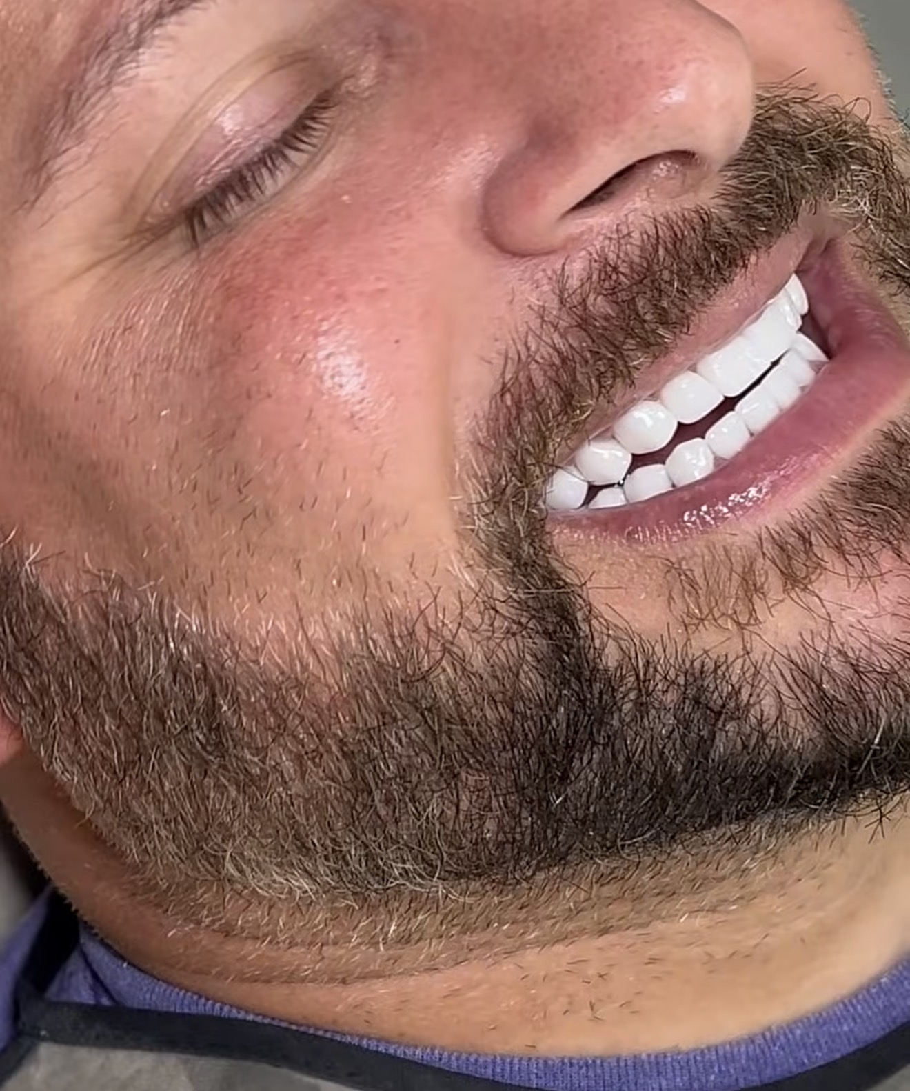 Close-up of teeth and lips