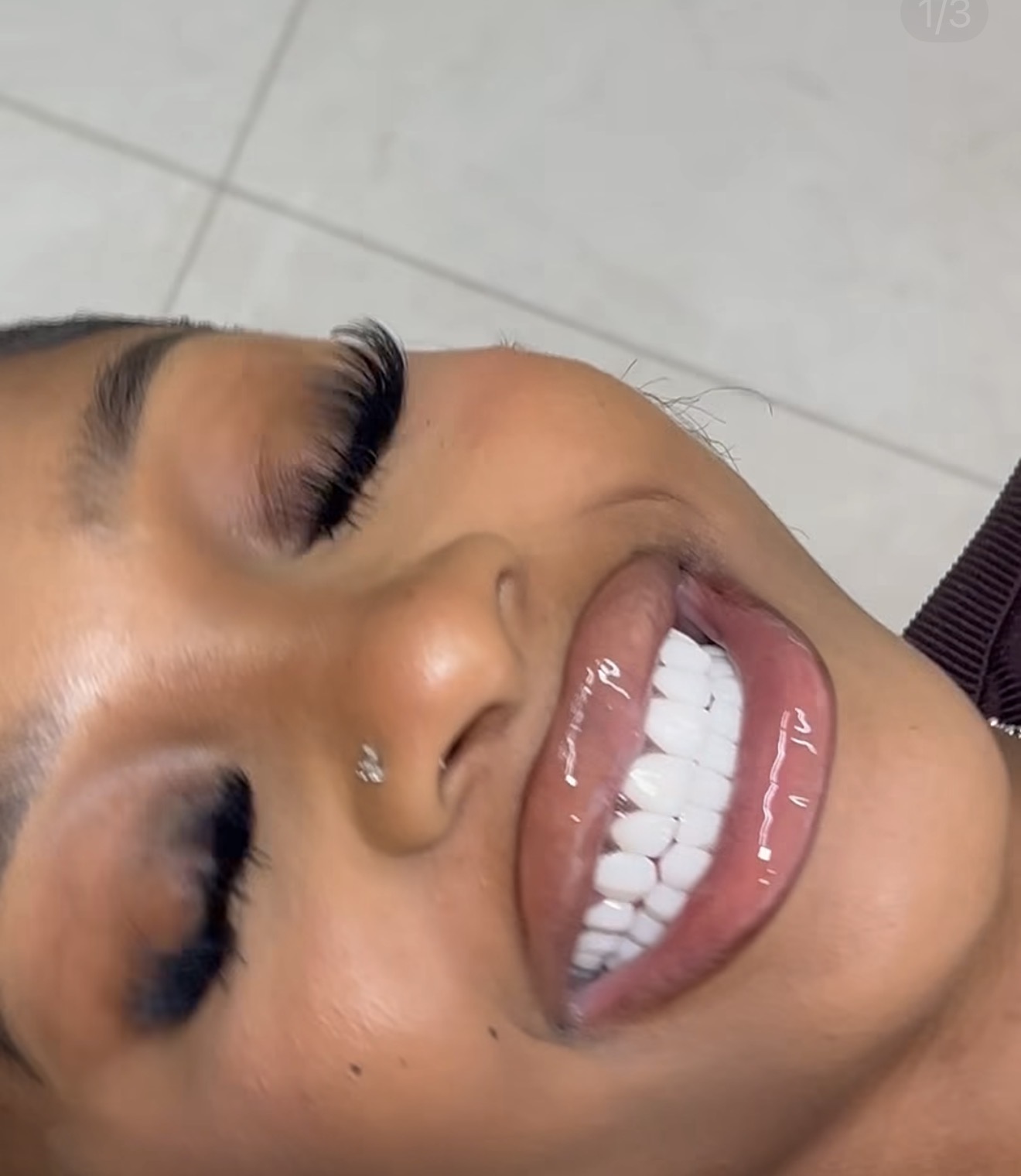 Close-up of a smile